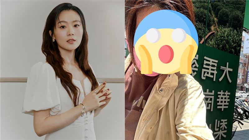 金鐘女星街上遭潑不明液體　超慘現況曝光