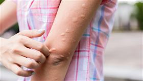 夏天總是被蚊子叮，搞不好妳有容易被「叮」上的體質。（圖／canva）