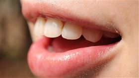 女子，牙齒，口腔，口臭(圖／Pexels)