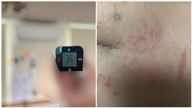 冷氣,私幼,疹子,黃瓊慧（圖／翻攝自臉書《黃瓊慧 桃園觀察日記》）