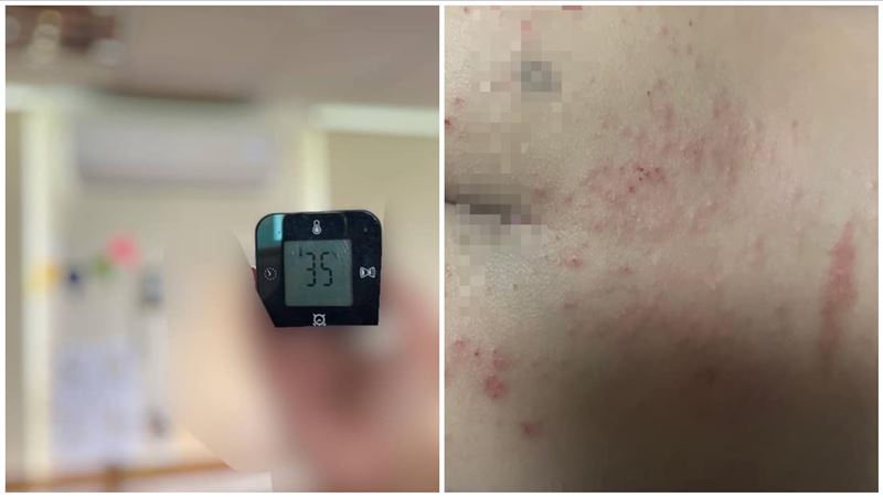 私幼冷氣壞一周沒修　幼兒熱到起疹子狂抓