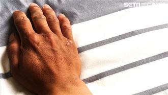 他20歲車禍從此癱瘓　認好不了只盼安樂死