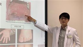臺中醫院兒童感染科醫師徐浩庭，腸病毒，三兄弟同時感染(圖／翻攝畫面)