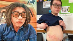 宏恩醫院護佐束衣綁病患狂虐打　他竟是搏擊練家子還有黑歷史