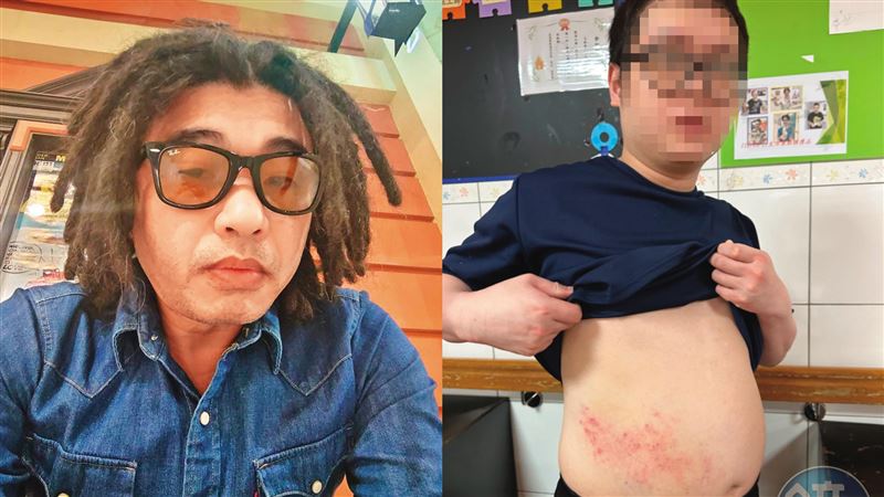 醫院綁病患虐打　他是搏擊練家子挖黑歷史