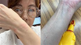 郭昱晴貼出「紅腫破皮照」。（圖／翻攝自郭昱晴臉書）