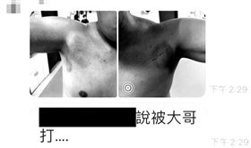 病人遭虐打全身傷，宏恩醫院龍安分院長曝「5天打倒10多人」，恐嚇醫護，林姓護佐保護醫護瘩，毆打(圖／翻攝畫面)