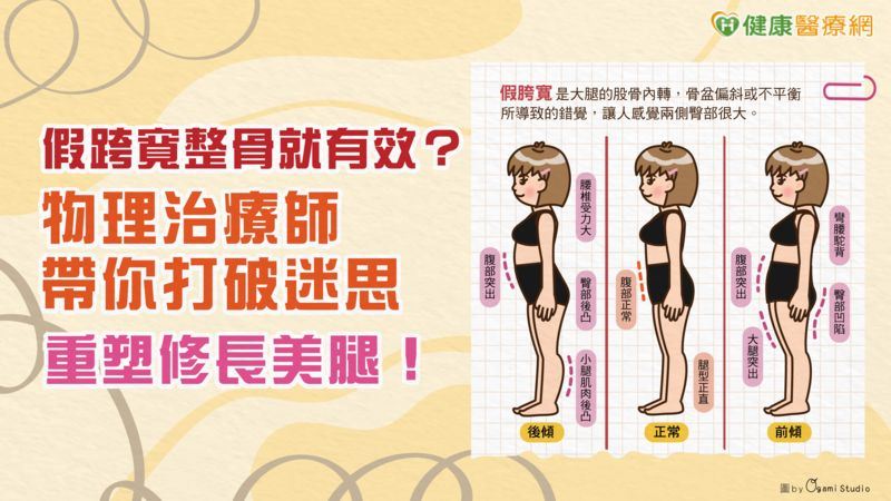 物理治療師帶你打破迷思　重塑修長美腿！