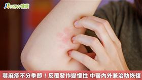 名家專用／鄭愛蓮醫師進一步說明，蕁麻疹誘發原因很多，要看個別過敏原為何，若本身為過敏體質相對好發，通常很多食物不能吃。（勿用）
