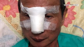 不滿預約位被轉讓　7旬翁遭暴毆打斷鼻梁