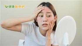 酒糟肌（Rosacea）又稱為玫瑰斑、酒糟性皮膚炎，是一種慢性的皮膚發炎狀態。