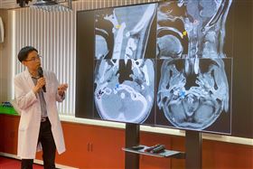 台中榮總,鼻咽癌(圖/翻攝畫面)