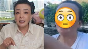 張蘭罹患白斑症。（圖／翻攝張蘭微博）