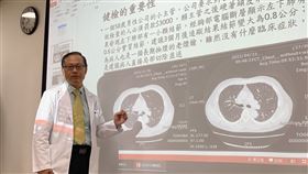 公司健檢救了一命！58歲老菸槍「不想被罰3千」一檢查竟確診肺腺癌。（圖／衛生福利部台中醫院提供）