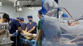 男性也能懷孕？世界首例實驗曝：胎兒在「人造子宮」存活90分鐘
（圖／翻攝自微博／頭條新聞）