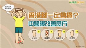 香港腳又稱為足癬，主要因為皮膚感染到某種黴菌所引發，病發時腳趾周圍開始出現脫皮的症狀，腳底逐漸會產生水泡，脫皮及水泡。