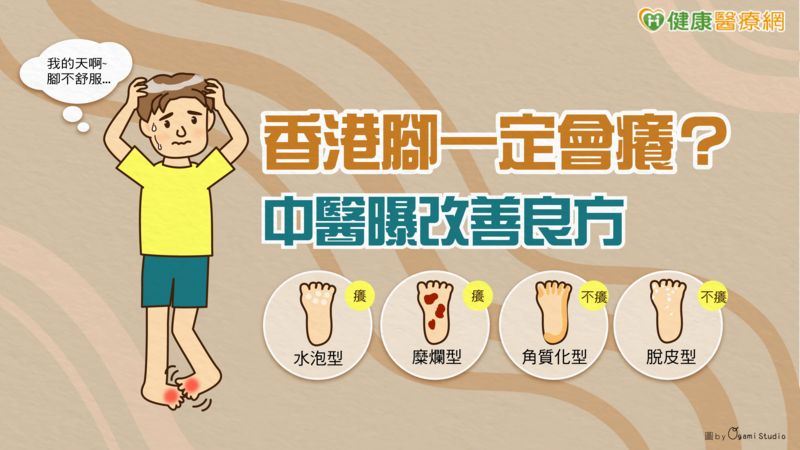 香港腳又稱為足癬,主要因為皮膚感染到某種黴菌所引發,病發時腳趾周圍開始出現脫皮的症狀,腳底逐漸會產生水泡,脫皮及水泡