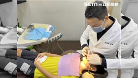 高雄,手術,牙醫,阻生齒,牙齒,門牙,高雄,林詩詠,矯正