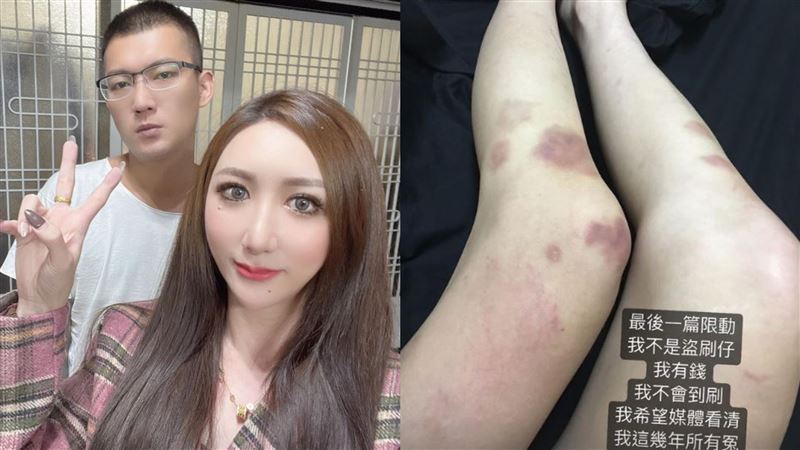 罔腰公開遭家暴影片　鳳梨稱：查埔人互毆