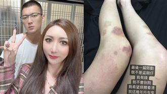 罔腰公開遭家暴影片　鳳梨稱：查埔人互毆