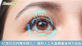 名家專用／朱智盟醫師曾收治1名50歲患者，從2019年做完白內障手術至今5年，視力追蹤穩定，當初選擇三焦點人工水晶體，術前近視度數1000度、術後0度，近視、老花、散光1次矯正，近距離的閱讀能應付自如，患者術後很開心能重獲視力自由。（勿用）