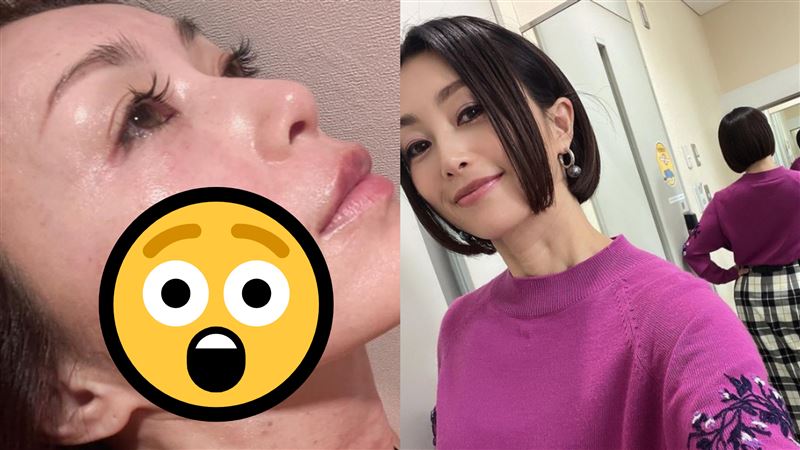 昔染毒毀形象！53歲擋泥板女神驚人近況曝