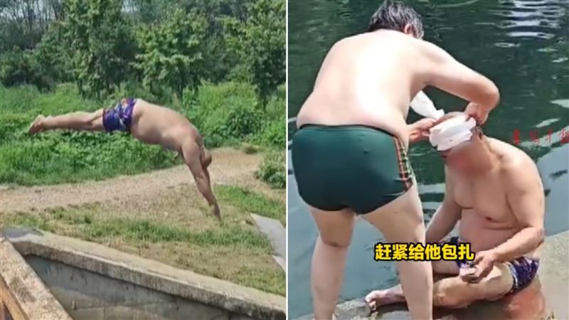 模仿水花消失術！阿伯跳公園水池撞破頭