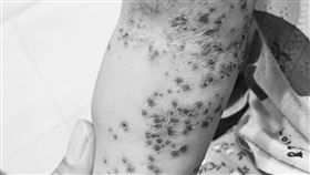 腸病毒,停課,幼兒園,女兒,媽媽