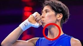 酸民狂轟林郁婷「有喉結」是男的，醫打臉：「那個是甲狀軟骨」。（圖／翻攝自YouTube頻道「蒼藍鴿的醫學天地」）