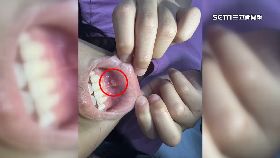 文 跨海救腸毒1800