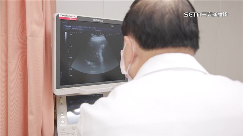 獨／超音波照出6手指　醫嗆一句孕媽淚崩