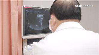 獨／超音波照出6手指　醫嗆一句孕媽淚崩