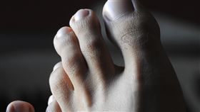 腳臭,腳。pixabay