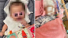 家屬控保母虐5月大女嬰 狂搖害腦出血恐變植物人