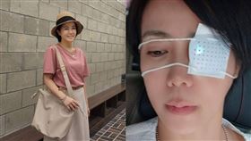 陳仙梅眼睛二度遭到兒子戳傷。（圖／翻攝自陳仙梅臉書）