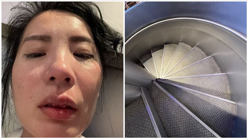 獨／小野麗莎經紀人慘摔　直擊百貨旋轉梯