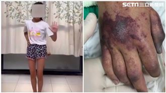 台南8歲女童感冒求診　一檢查直接住進ICU