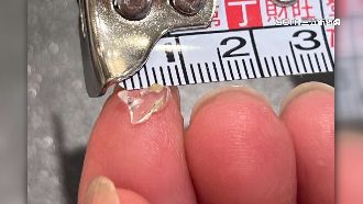 獨／網購毛豆藏玻璃　消費者控廠商消極