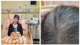 小彤化療後暴瘦又落髮（圖／翻攝自臉書）