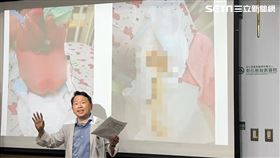 女嬰，月子中心，尿布疹，滲血拉血便，兒童醫院主任蔡易晉(圖／翻攝畫面)