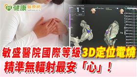 根據敏盛醫院統計，自3年前引進此技術後，院內已執行超過150例心臟電燒治療，在陣發性心房顫動方面，術後成功率可達約八成以上，持續性心房顫動則約有七成以上，成績達到國際相關研究水準。