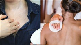 背部痘痘長不停竟跟遺傳有關？醫師曝美背養成6大招：護髮順序別搞錯(圖/姊妹淘)