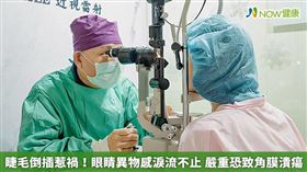 睫毛倒插很常發生在中老年人身上，因為隨著年紀漸長而老化，導致支撐眼瞼的肌肉無力、鬆弛，進而造成眼瞼內翻（勿用）