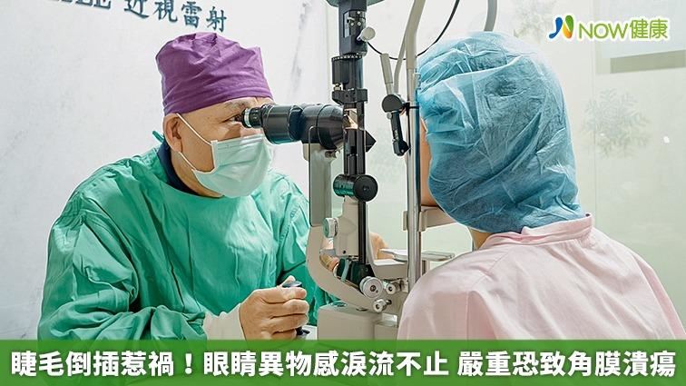 睫毛倒插！眼睛異物感　嚴重恐致角膜潰瘍