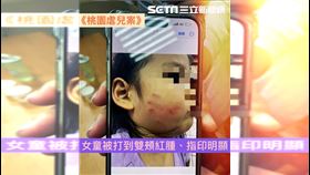 太可惡！女童不睡遭教保員狠賞巴掌留血痕（圖／翻攝臉書）