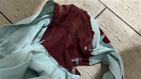 男童上廁所時解出大量鮮紅色血便。（圖／童綜合醫院提供）