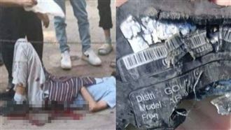 「死亡嗶聲後」湊近看...5公克炸臉血模糊