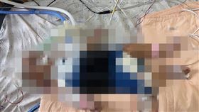 寶寶現在呼吸要靠插管及升壓藥物才能續命，眼前又要面臨腦死危機，爸媽心急如焚。（圖／翻攝畫面）
