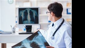 父女同罹肺癌！家族史不容小覷醫：晚期肺癌五年關鍵存活率翻倍（業配勿用）