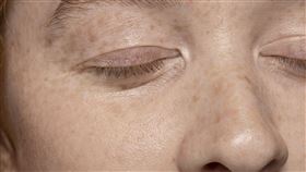 秋老虎黑斑記憶甦醒！日夯「吃得美白」7天見效 擊退「楓葉肌」（業配勿用）